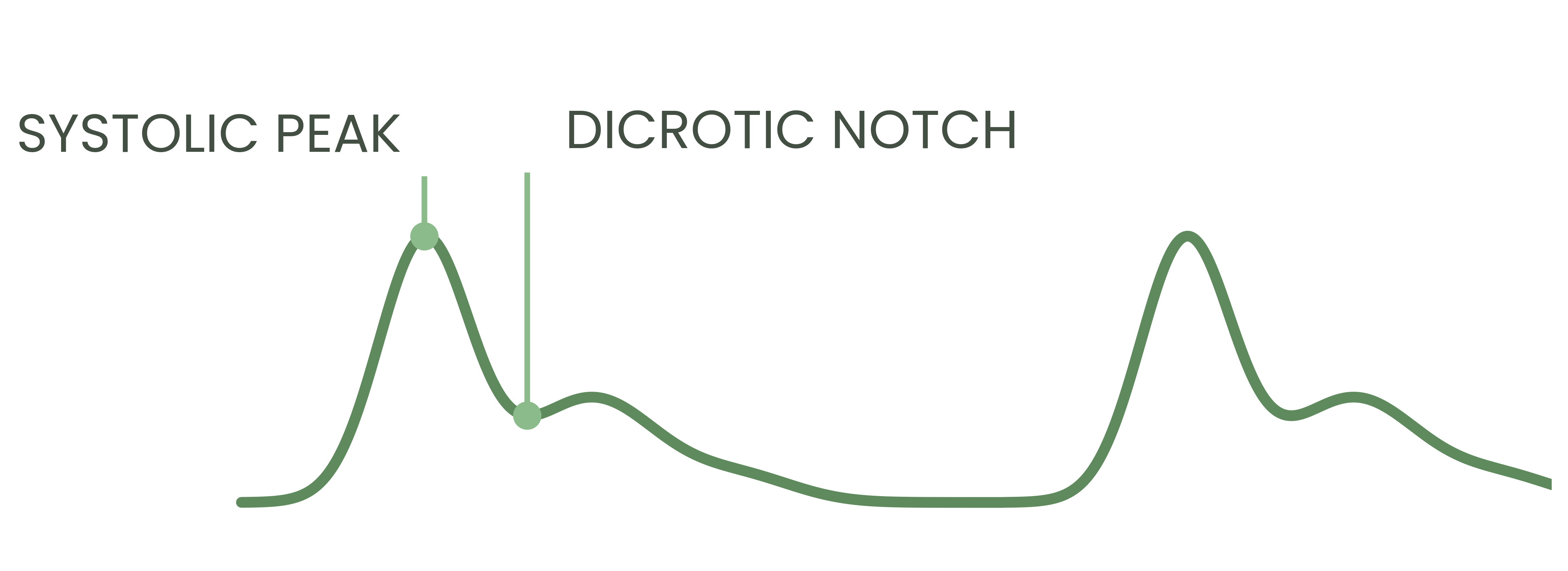 Blood Flow Waveform
